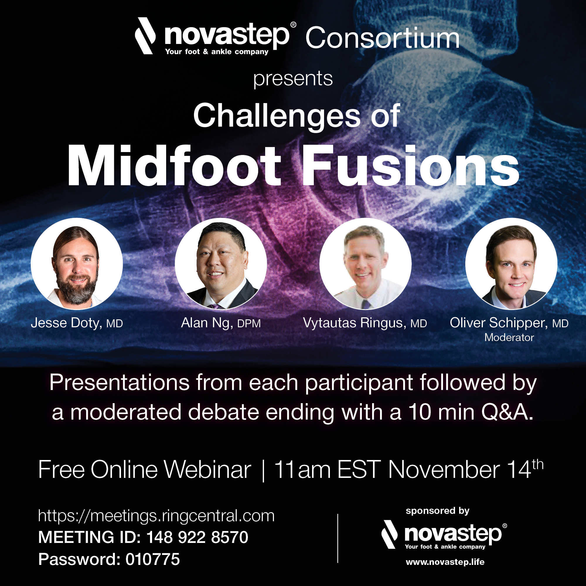 Challenges of Mid Foot Fusions | November 14th, 2020 | Webinar in English