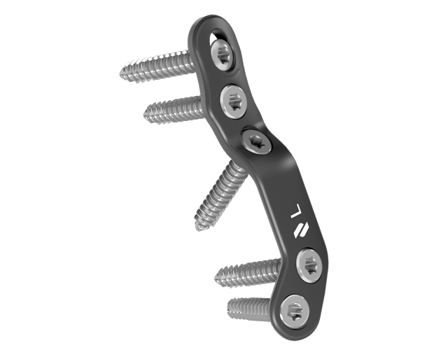 Plantar Lapidus plates Novastep International